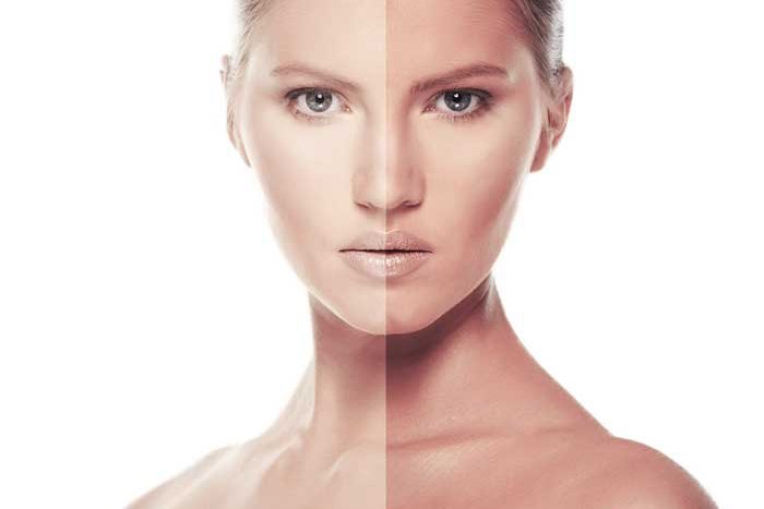 Dermabrasion Dr. Tribull